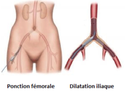 Chirurgie vasculaire tunisie